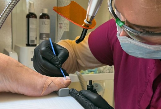 Курсове по подология в България: Усвоете метода Brace M и станете експерт в корекцията на вратснали нокти