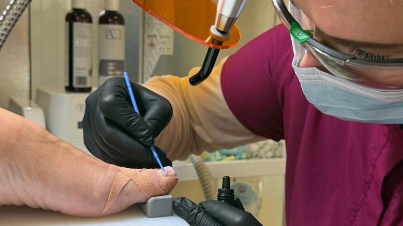 Курсове по подология в България: Усвоете метода Brace M и станете експерт в корекцията на вратснали нокти