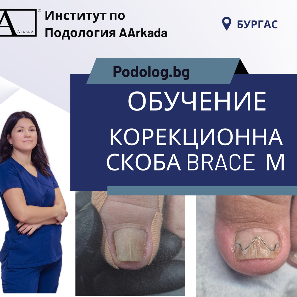 Курс Brace M AArkada. Ефективна корекция на деформирани нокти